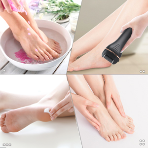 Why the Pro Electric Pedicure Tool Is a Game-Changer for At-Home Foot Care